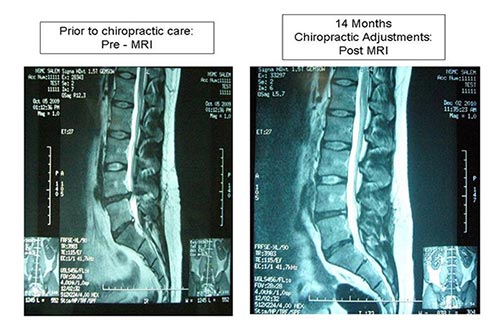 Chiropractic Durham NC Testimonial Spine MRI Chiropractic Durham NC Testimonial Spine MRI